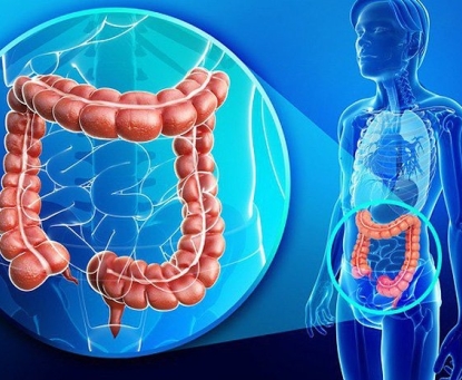 Ung thư đại tràng có nguy hiểm không